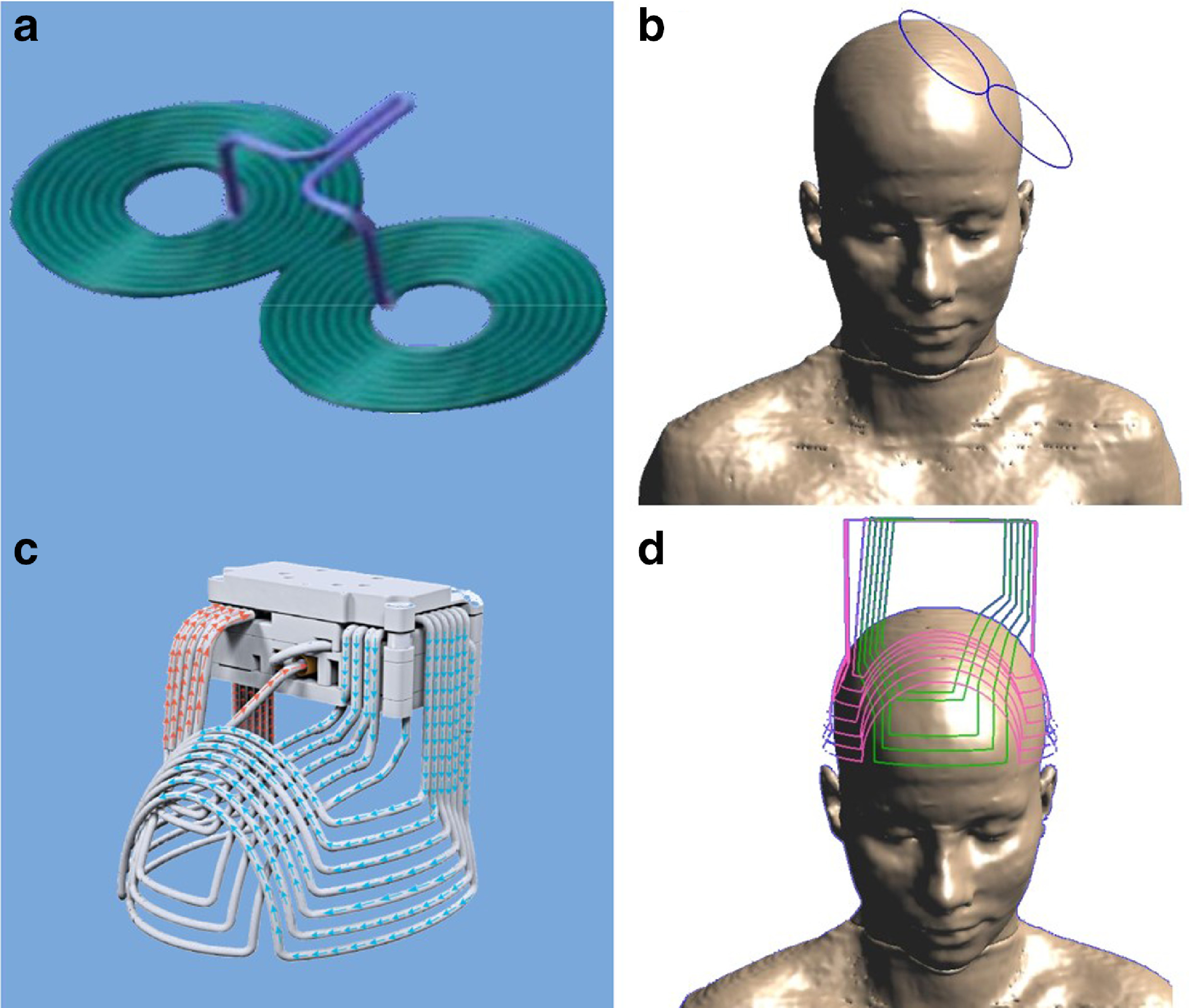 Overview of technologies in Transcranial Magnetic Stimulation - Brighter  Day Psychiatry TMS Clinic